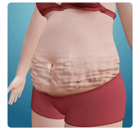 GuruTrim Natural Slimming Patch For Weight Loss